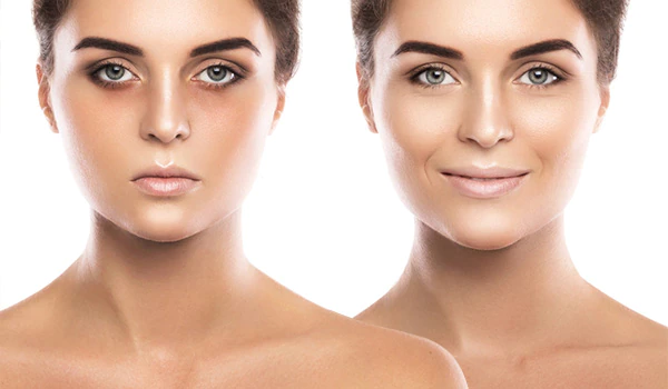 Get rid of dark under eyes_MobileHomeFeature
